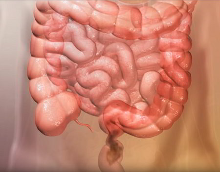 Small intestine (center) surrounded by large intestine, colon