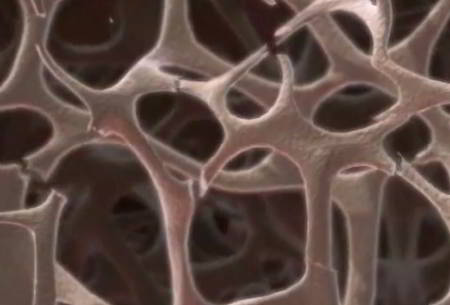 Close-up of honeycomb bone structure showing micro-cracks