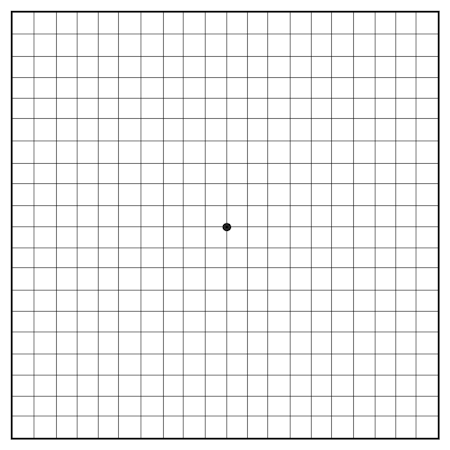 The Amsler grid, used for assessing quality of central vision