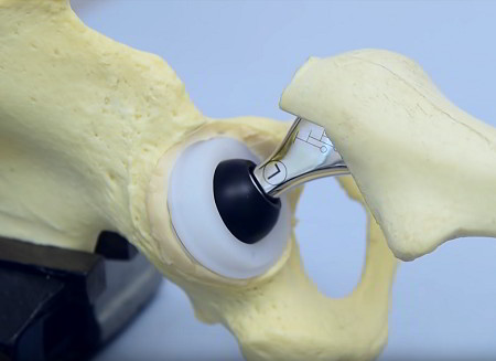Demonstration of artificial hip joint with femur and hip socket