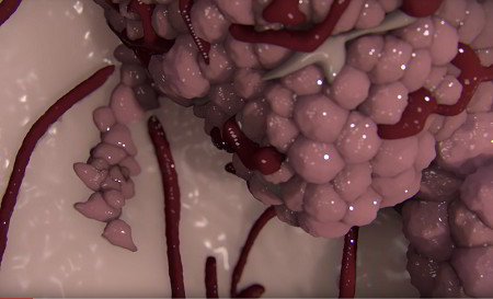 Close-up of cancer cells showing new blood vessels growing