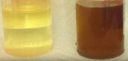 Two urine samples, light yellow on left and brown on right
