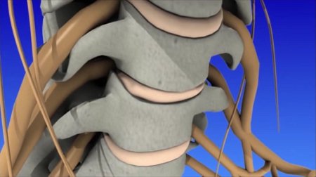 Healthy cervical spine showing vertebrae, discs, exiting nerves