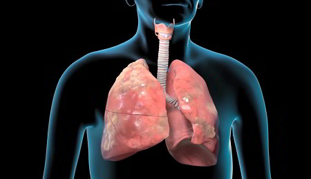 Transparent upper torso showing lungs damaged by COPD