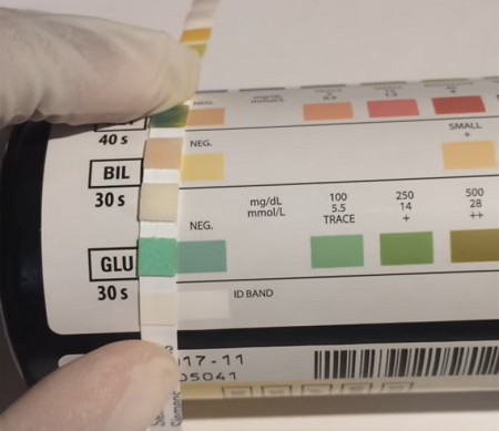 A urine test strip being compared to manufacturer's color scale